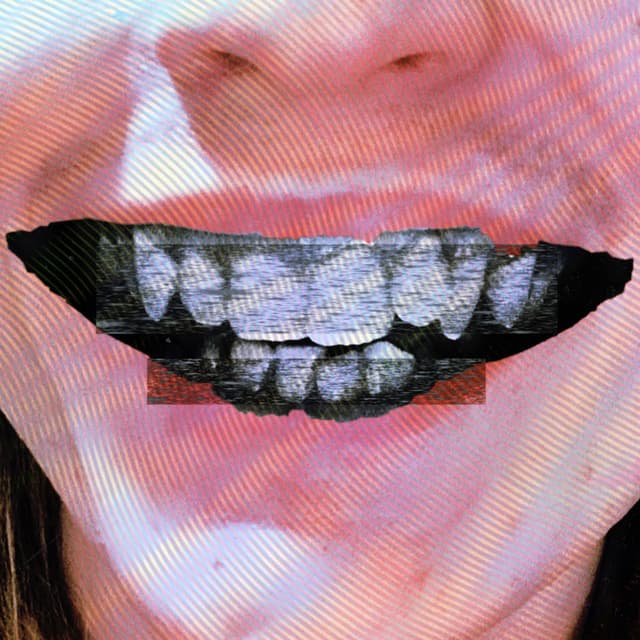 Diamonds in my teeth.
