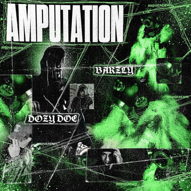 Amputation